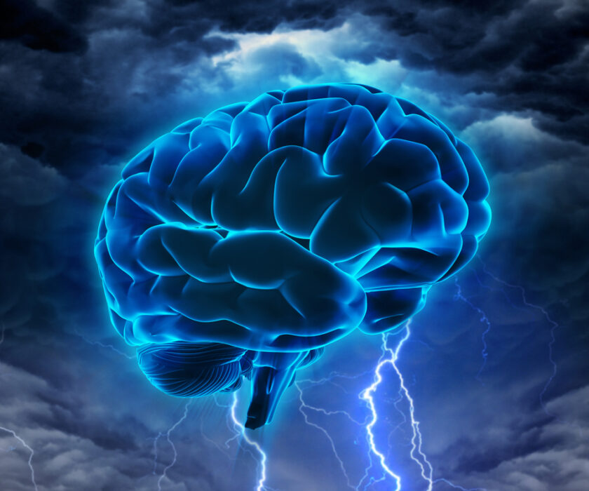 BRAIN_LIGHTNINGshutterstock_197557379 copy